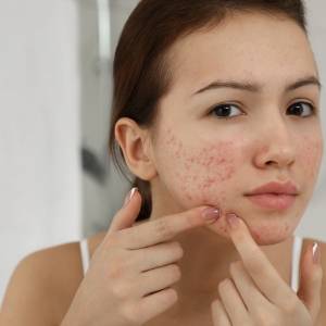 Skin treatment Great Yarmouth NR31